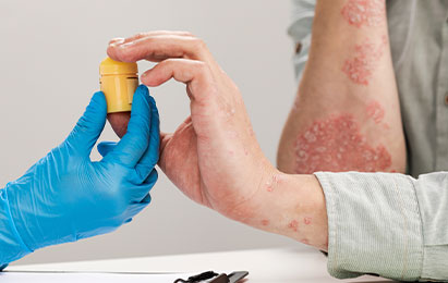 Fungal & Bacterial Infections